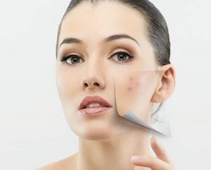 5 วิธีพอกหน้า ลดรอยสิวและจุดด่างดำ ทำให้หน้าใสแบบธรรมชาติ